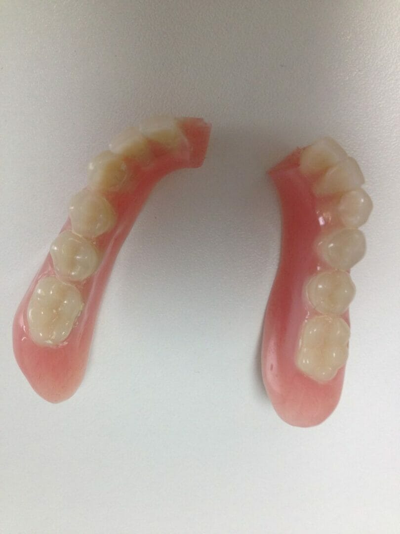 Same Day Denture Repairs The Natural Denture Clinic