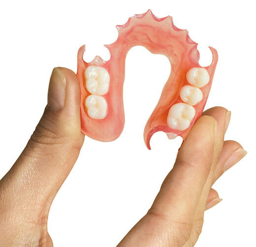 Flexi dentures
