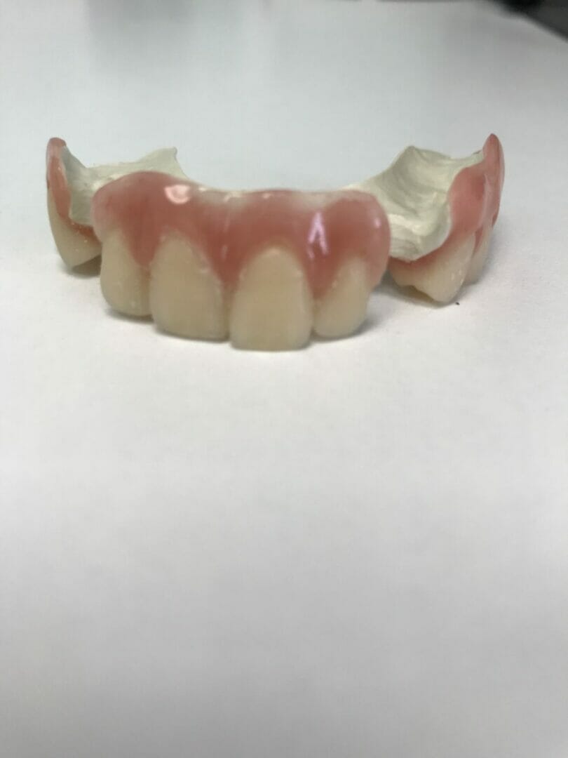 Standard Dentures Premium Dentures Bedhampton Hampshire