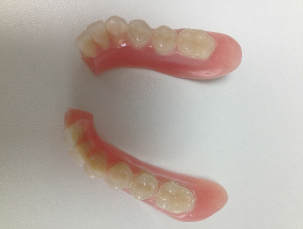 Fractured Denture Repair Bedhampton Hampshire The NDC